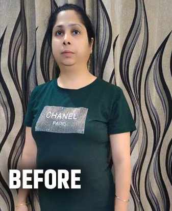 Weight Loss Transformation